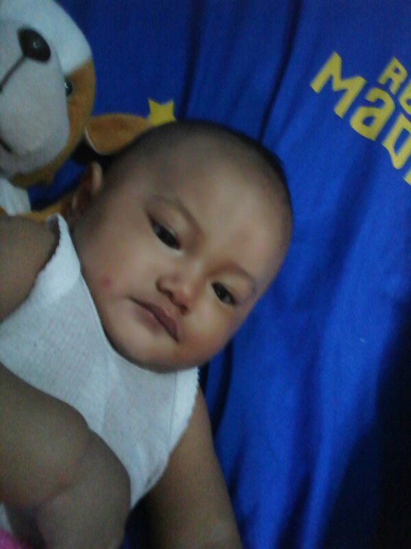 bekas gigitan nyamuk