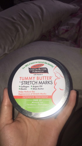 Tips on how to prevent stretch marks?