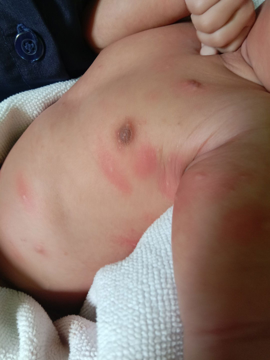 Badan bayi bintik merah