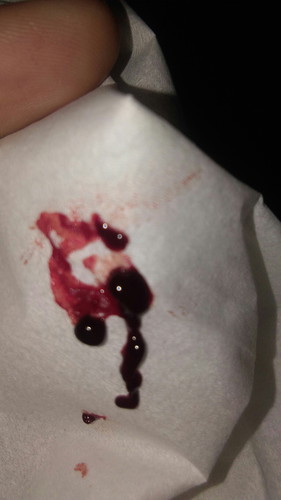 apa ini??? jangan di buka bagi yang takut