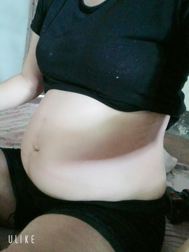 กำหนดคลอด