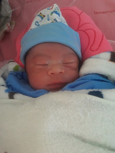 แชร์ประสบการณ์การคลอด36w6d