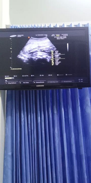 ทักทายค่ะแม่ๆ