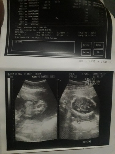 Baby Boy or Baby Girl?