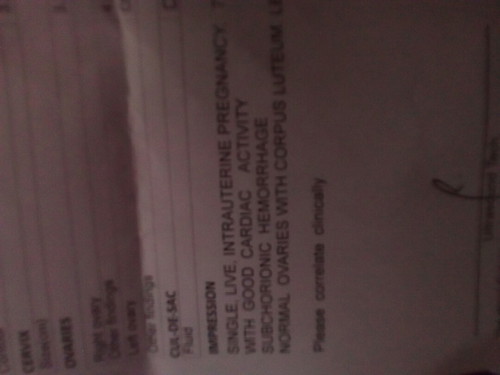 pangpakapit na injection