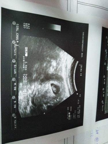 ลูกน้องของฉันดีใจมากเลยลูกคนที่2ของบ้าน