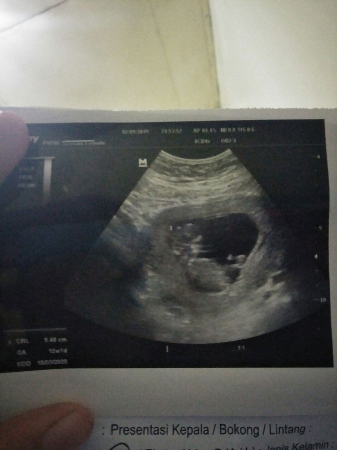 USG KE DUA DAN KE TIGA BEDA UMUR KANDUNGAN