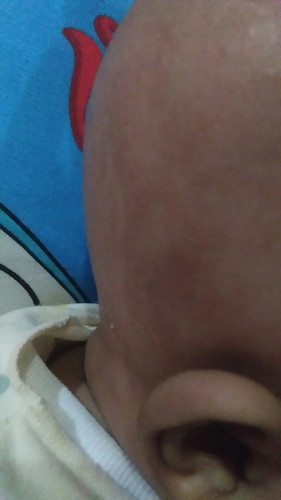 kulit kepala