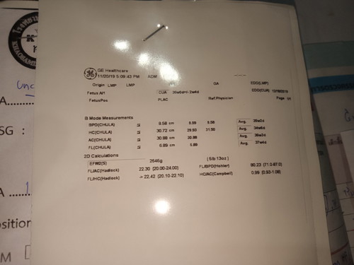 ผลอันตราซาว