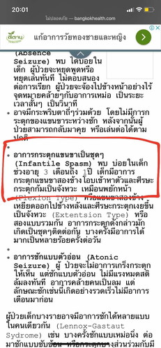 กระตุกๆเกร็งๆ
