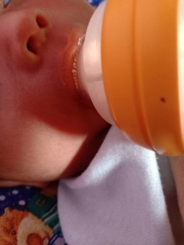 bibir bayi kering
