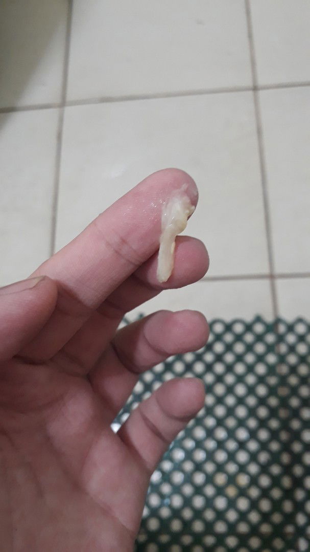 #TeamJuly #Discharge