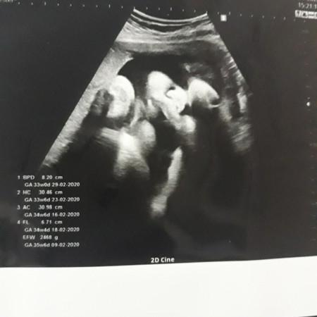 #อัพเดตน้ำหนักเจ้าตัวน้อยในท้องกันหน่อยจร้า