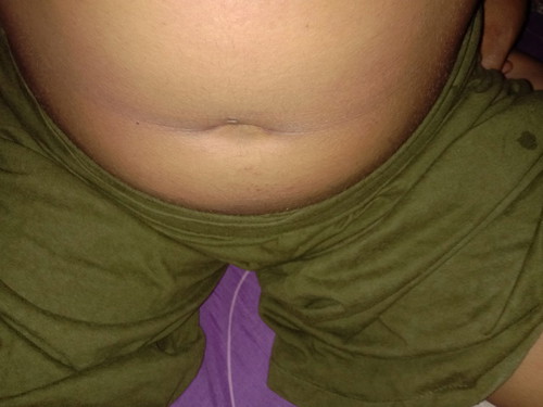 มีเเม่ๆบ้านใหนเป็นไทรอยท์เป็นพิษเเล้วตั้งครรภ์มั้ยค้ะ พอดีเป็นไทรอยท์เเล้วตั้งครรภ์ได้3เดือนเเล้วอ่ะค้ะ อยากทราบว่ามีใครเป็นตอนตั้งท้องมั้ยค้ะ มันอันตรายขนาดไหน มันมีทางเเก้ใขมั้ยค้ะ