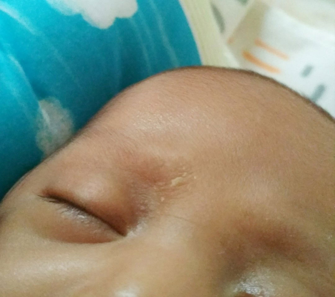 Kulit Bayi