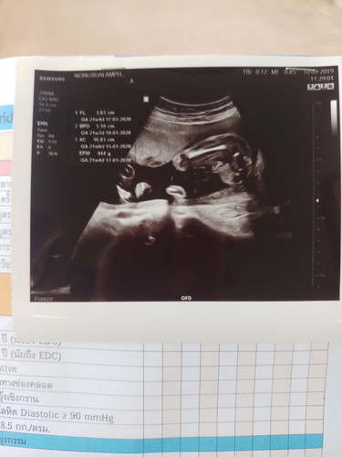 ดูไม่เปนค่าหมอไม่บอกเเพศ