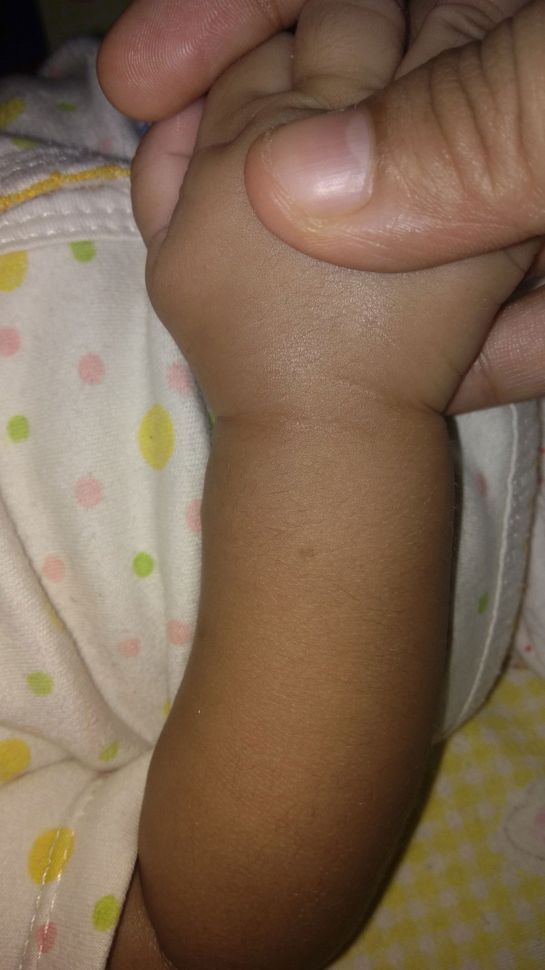 bekas gigitan yg menghitam