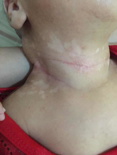 สอบถามแม่บ้านอื่นหน่อยค่ะ