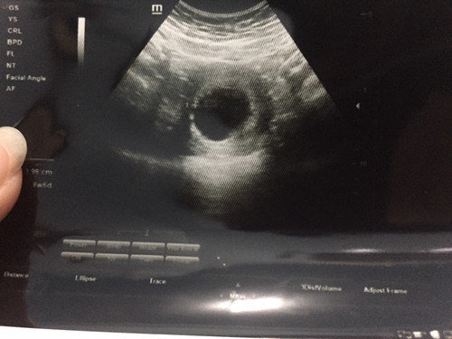 9 week