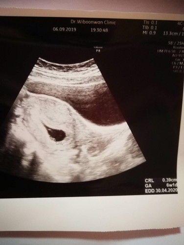 เครียดมากเลยคะ?