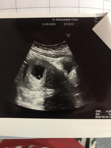 เขาไม่อยู่กับเราแล้ว ??