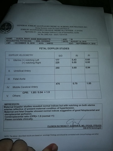 Ob Doppler Result