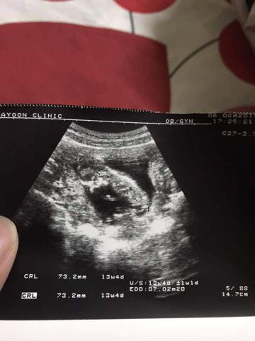 สอบถามค่ะ