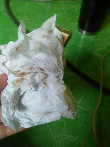 40+1 w. มีมูกสี น้ำตาลดำๆ