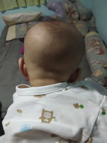 แบบนี้คอลูกเอียงมั้ยคับ
