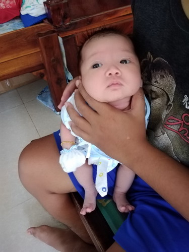 ผ่าคลอดฉุกเฉิน