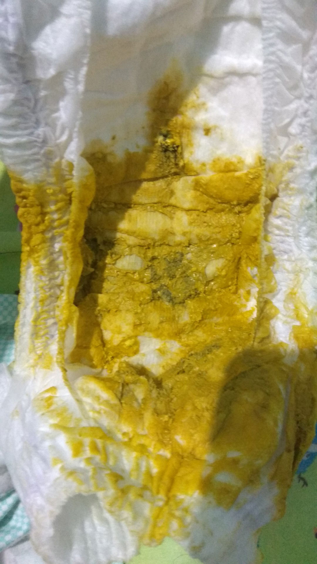 BAB bayi 2 bulan 15 hari