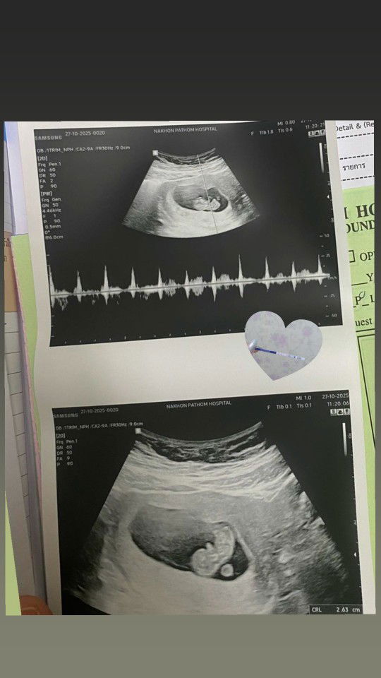 ณาราภัทร เพชรเดช profile icon