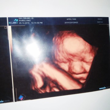 37w2d janin udh 3,2 wory nih bun takut kegedean?