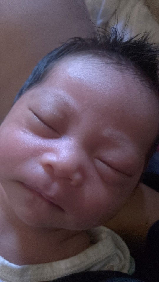 ตุ่มแบบนี้คืออะไรคะ