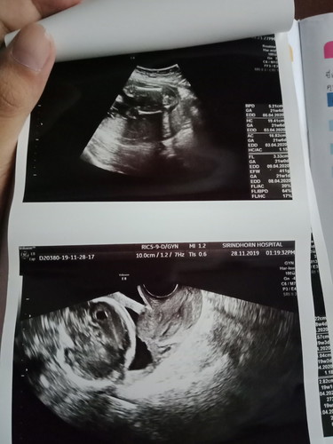 ใช่เพศไมค้ะ