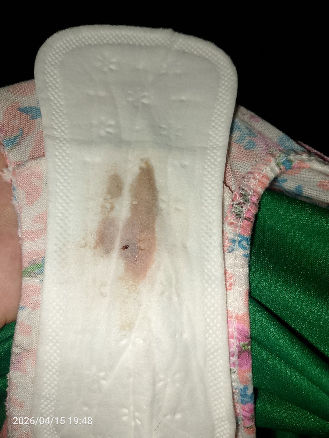 normal lang poba sa 32 weeks na preggy yung may ganitong discharge