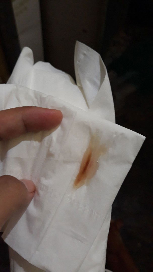 Apakah tanda mau melahirkan?