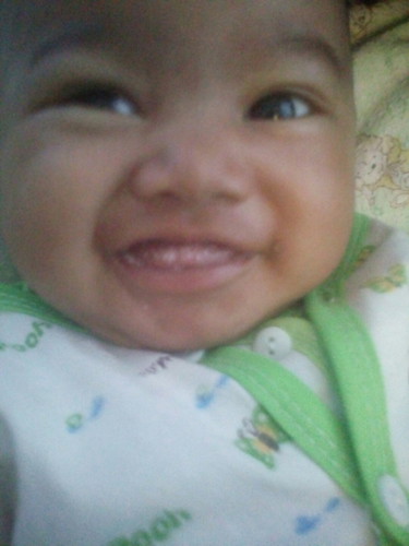 mulut berjamur