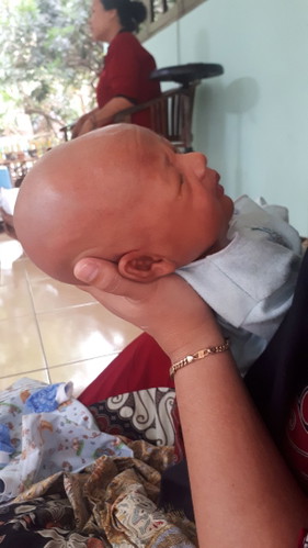 kepala bayi
