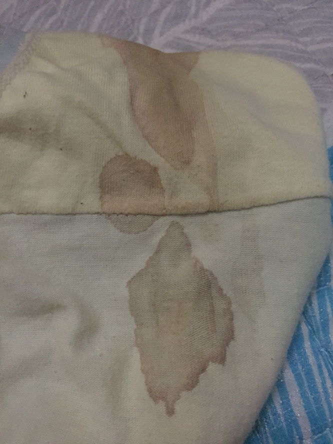 Blood or Leukorhea???