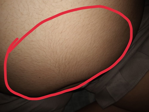 ลูกลอยตัวขึ้นมารึป่าว??