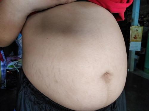 28 week