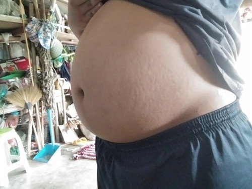 ท้องเล็กไปไหม ขอโทดนะค่ะอาจจะยาวไปหน่อย