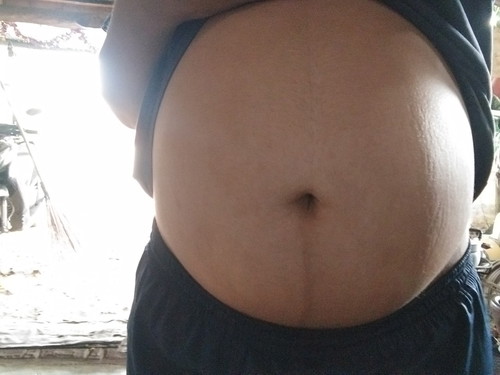 32week