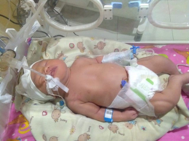 Pneumonia pada bayi baru lahir