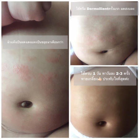 แชร์ประสบการณ์