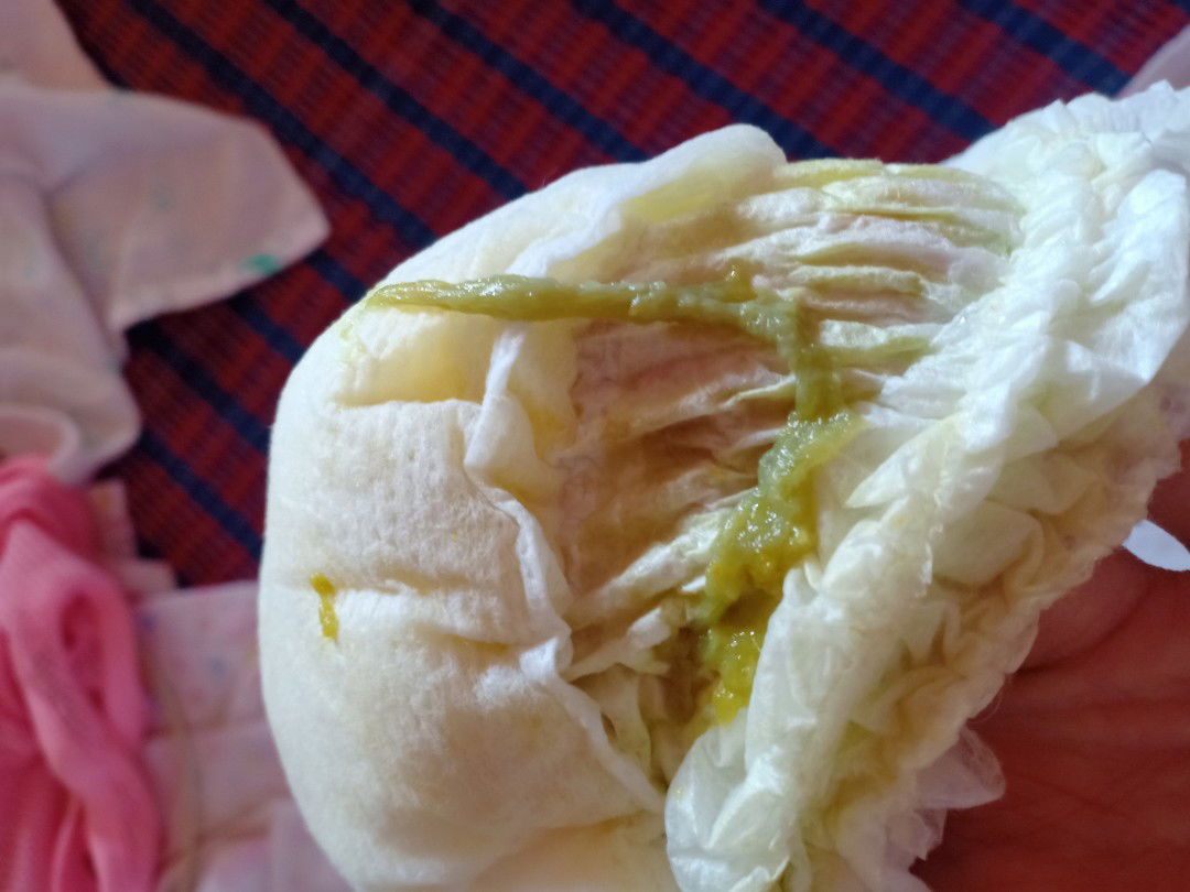 อึลูก น้องอายุ2เดือน13วัน