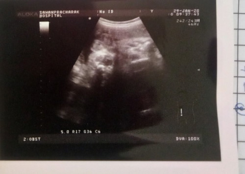 37+4 แล้วลุ้นๆๆ