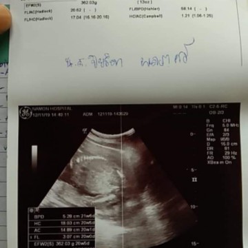 6เดือนแล้วจ่า?