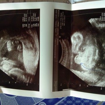 1เมษายน2563❤น้องเป็นผู้ชายคร้า?ทรีมเมษาครับ?